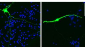 Cellule neuronali